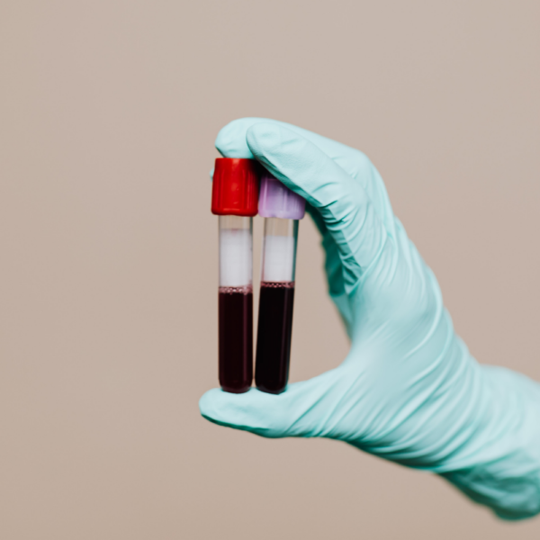 Muestras de sangre